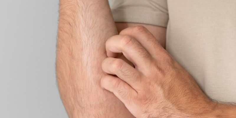 Tanda-Tanda Deodoran Tidak Cocok/Freepik.com