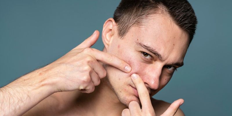 Masalah Kulit yang Sering Dialami Pria/Freepik.com