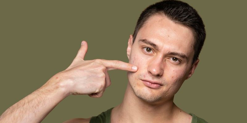 Kebiasaan Buruk yang Merusak Kulit/Freepik.com