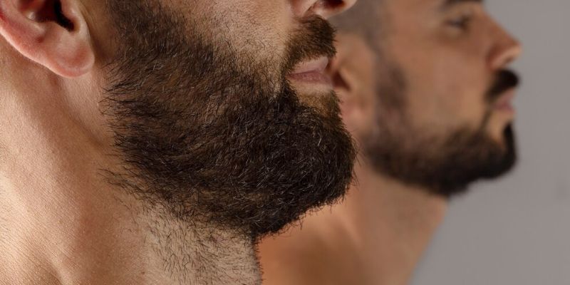 Bisakah Menumbuhkan Rambut Wajah dengan Derma Roller? Cek Fakta Dulu!