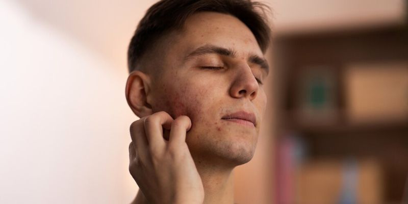 Derma Roller untuk Menumbuhkan Rambut Wajah/Freepik.com