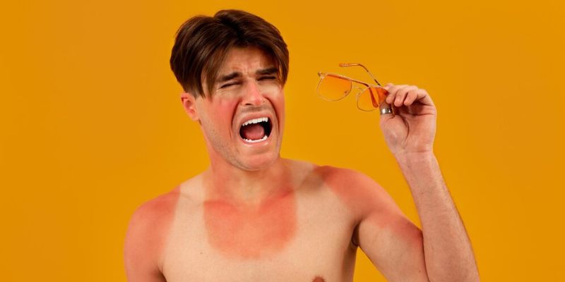 Sunburn/Freepik.com