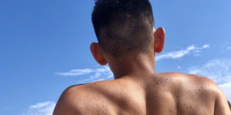 Penyebab Iritasi pada Kulit Pria/Freepik.com