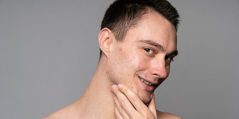 Masalah Kulit saat Puasa/Freepik.com
