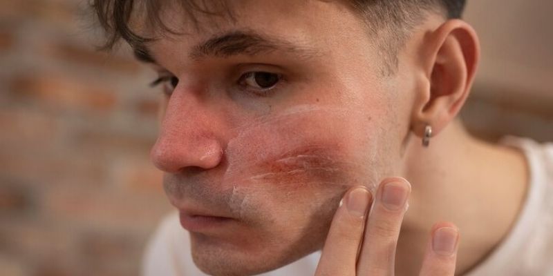 Penyebab Iritasi pada Kulit Pria/Freepik.com