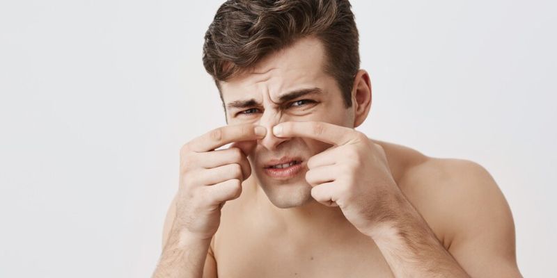Kenali Penyebab Blackhead pada Hidung yang Bikin Wajah Jadi Kusam