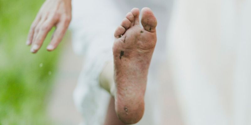 Penyebab Kaki Kering dan Pecah-Pecah yang Perlu Diwaspadai