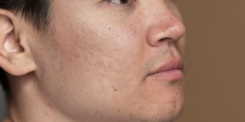 Blackhead/Freepik.com