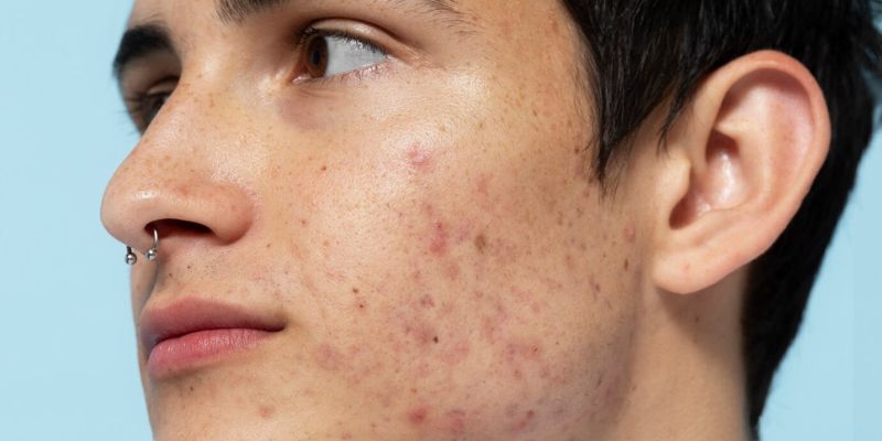 Blackhead/Freepik.com
