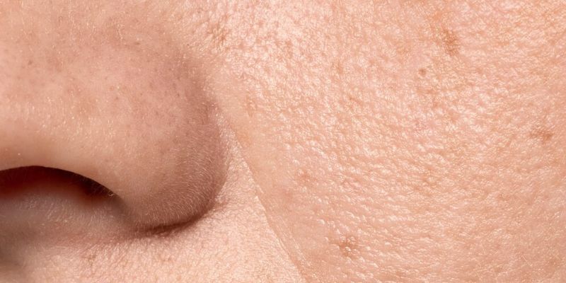 Blackhead/Freepik.com