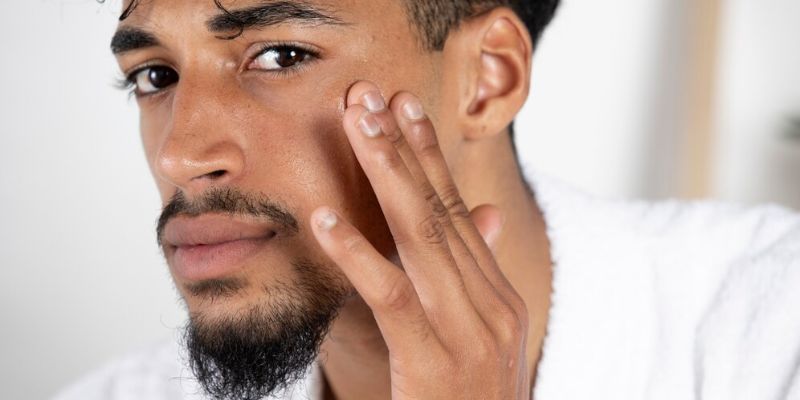 Tips Sederhana Menangani Dark Spot Sendiri di Rumah