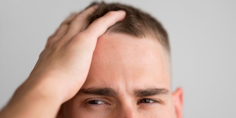 Kenapa Bisa Muncul Jerawat di Kulit Kepala? Begini Penjelasannya