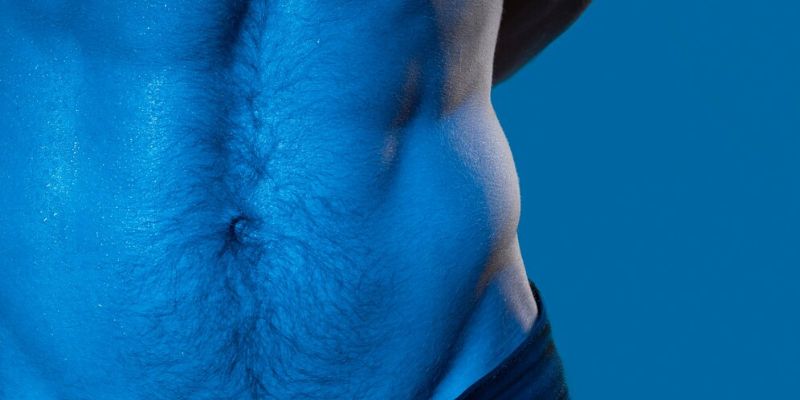 Stretchmarks pada Pria