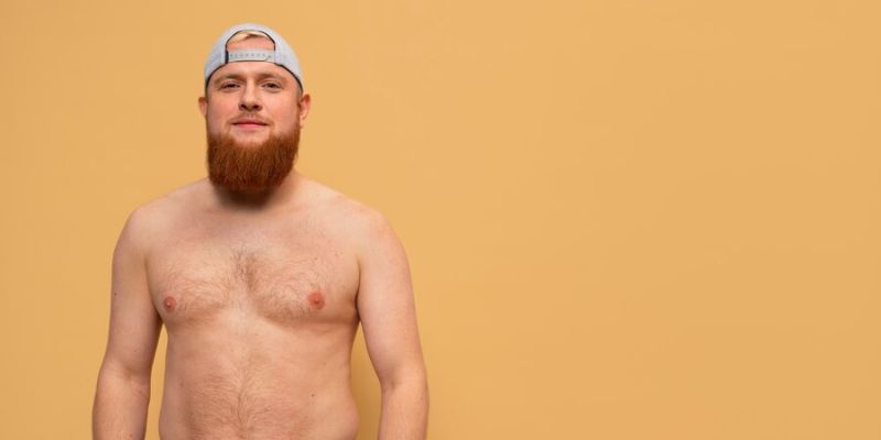Penyebab Stretch Marks pada Pria