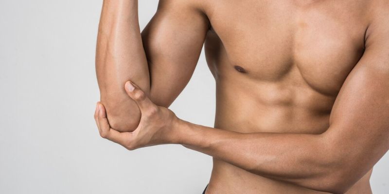 Stretchmarks pada Pria